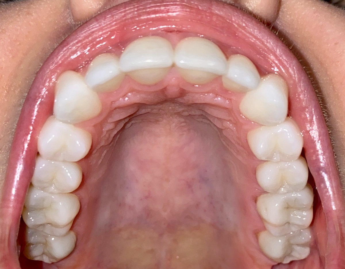 Hillcrest Orthodontics