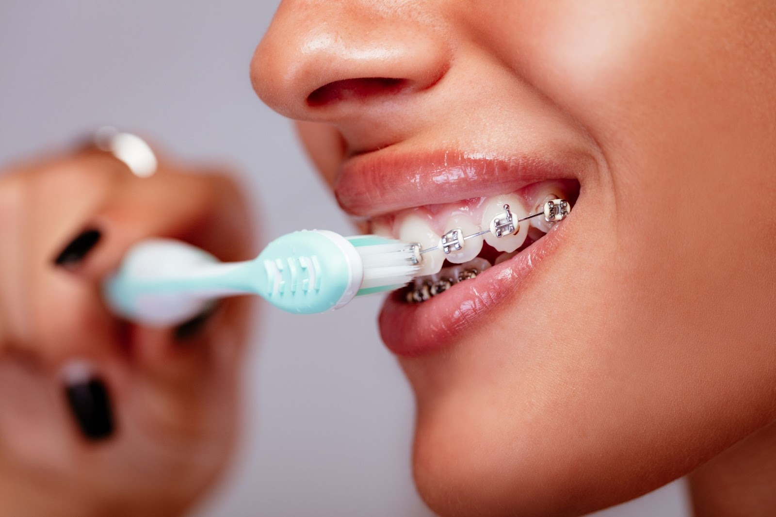 Brushing Tips for Braces Patients